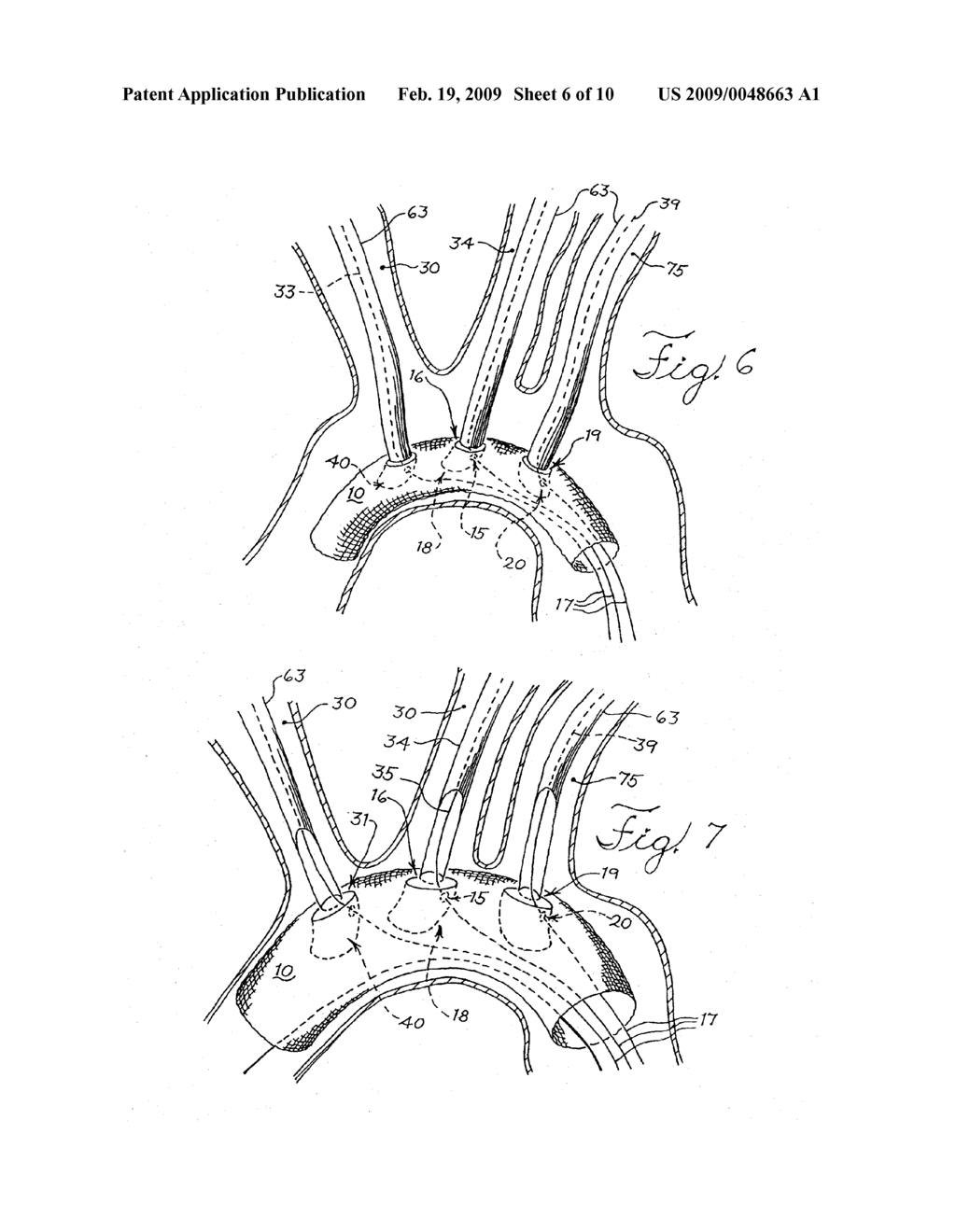 BRANCHED STENT GRAFT SYSTEM - diagram, schematic, and image 07