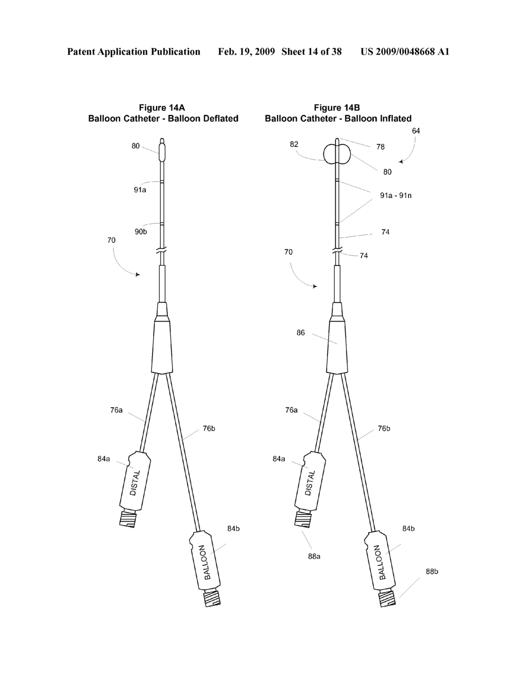 System and Method for Implanting a Heart Implant - diagram, schematic, and image 15