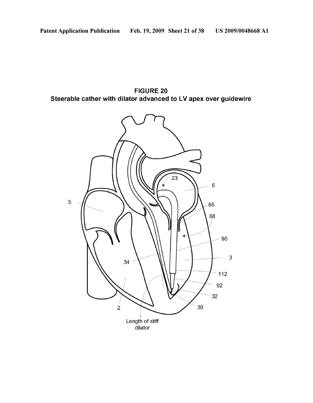 System and Method for Implanting a Heart Implant - diagram, schematic, and image 22