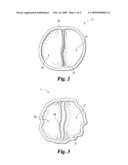 METHODS AND SYSTEMS FOR MODIFYING VASCULAR VALVES diagram and image