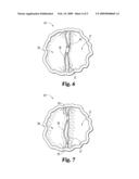 METHODS AND SYSTEMS FOR MODIFYING VASCULAR VALVES diagram and image