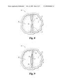 METHODS AND SYSTEMS FOR MODIFYING VASCULAR VALVES diagram and image