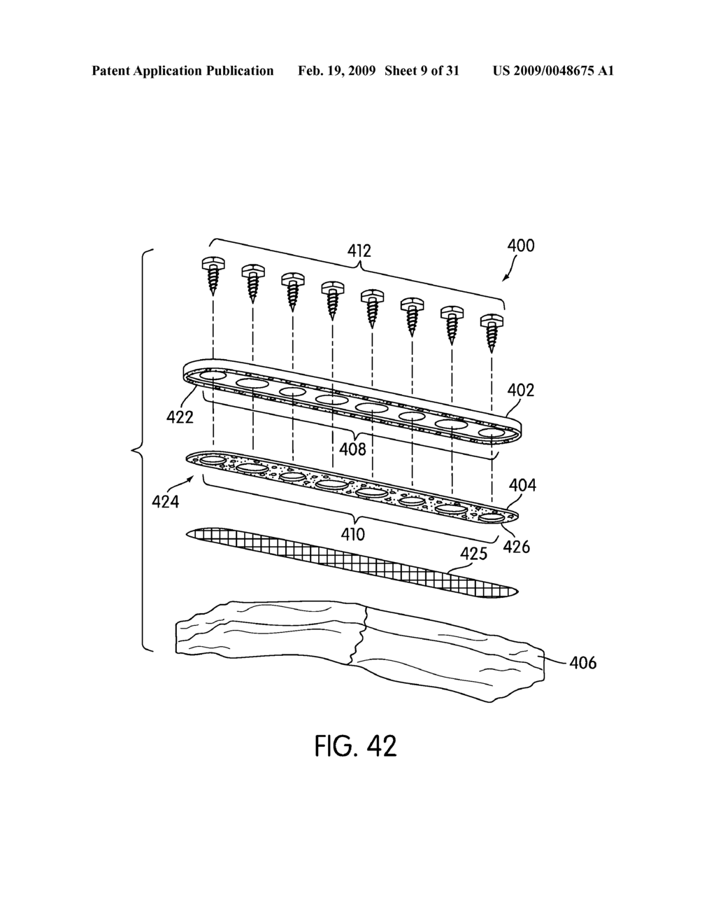 Spinal Fusion Implants with Selectively Applied Bone Growth Promoting Agent - diagram, schematic, and image 10