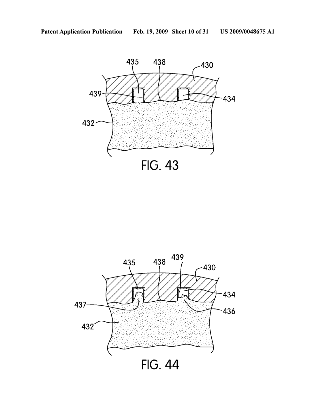 Spinal Fusion Implants with Selectively Applied Bone Growth Promoting Agent - diagram, schematic, and image 11