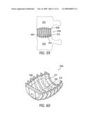 Spinal Fusion Implants with Selectively Applied Bone Growth Promoting Agent diagram and image