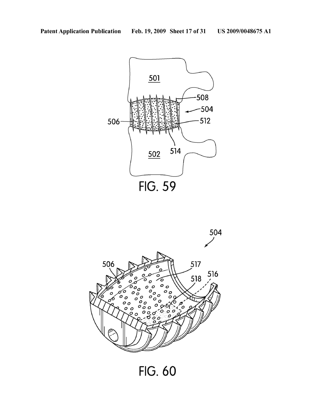 Spinal Fusion Implants with Selectively Applied Bone Growth Promoting Agent - diagram, schematic, and image 18