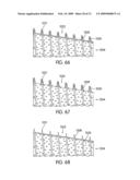 Spinal Fusion Implants with Selectively Applied Bone Growth Promoting Agent diagram and image