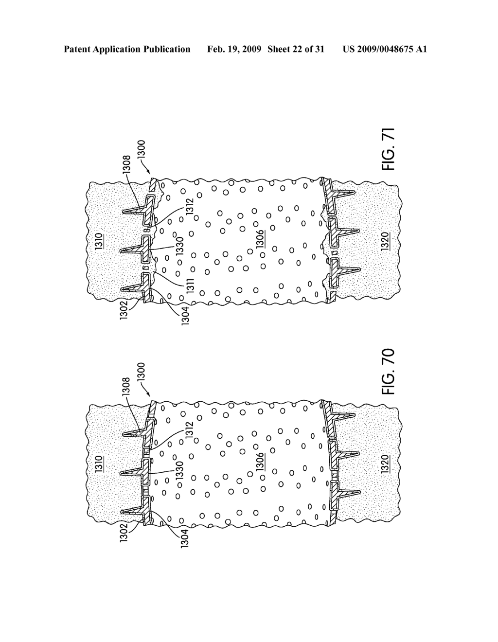 Spinal Fusion Implants with Selectively Applied Bone Growth Promoting Agent - diagram, schematic, and image 23