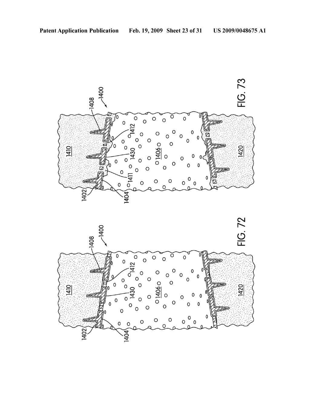 Spinal Fusion Implants with Selectively Applied Bone Growth Promoting Agent - diagram, schematic, and image 24