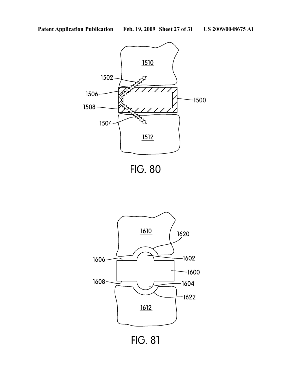 Spinal Fusion Implants with Selectively Applied Bone Growth Promoting Agent - diagram, schematic, and image 28