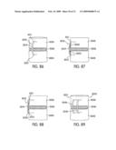 Spinal Fusion Implants with Selectively Applied Bone Growth Promoting Agent diagram and image