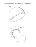 IMPLANT diagram and image