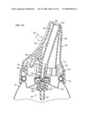 Lockable dispenser diagram and image