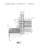 Structure Containing Wound Treatment Material diagram and image