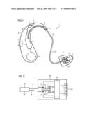 Automatic identification of receiver type in hearing aid devices diagram and image