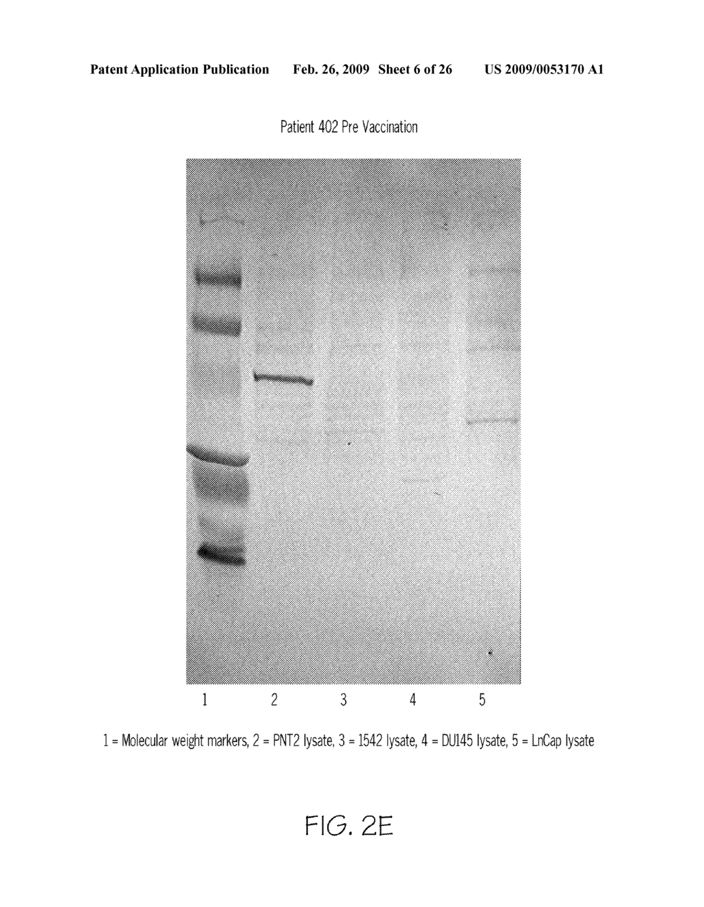 HUMAN PROSTATE CELL LINES IN CANCER TREATMENT - diagram, schematic, and image 07