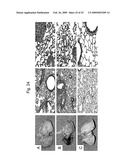 Blockade of Pin1 Prevents Cytokine Production by Activated Immune Cells diagram and image