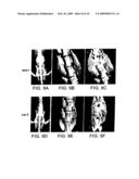 Pharmaceutical Compositions for Treating or Preventing Bone Conditions diagram and image