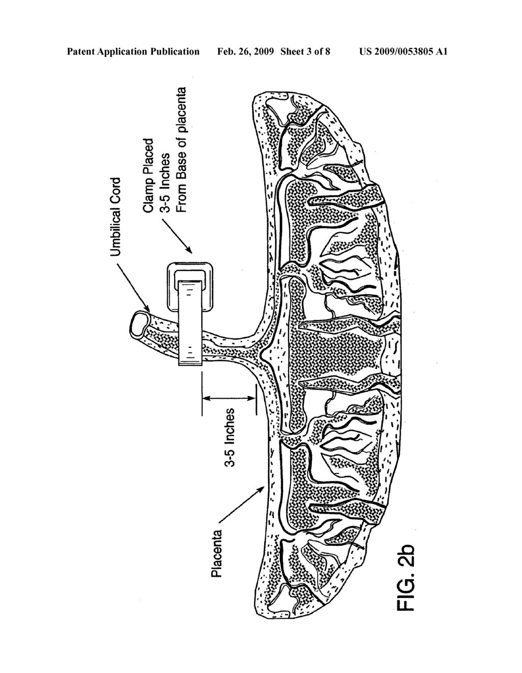 POST-PARTUM MAMMALIAN PLACENTA, ITS USE AND PLACENTAL STEM CELLS THEREFROM - diagram, schematic, and image 04