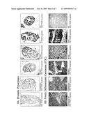 Phytoestrogens As Regulators Of Hedgehog Signaling And Methods Of Their Use In Cancer Treatment diagram and image