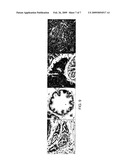 Phytoestrogens As Regulators Of Hedgehog Signaling And Methods Of Their Use In Cancer Treatment diagram and image