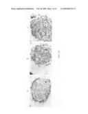 Use of histone deacetylase inhibitors in combination with radiation for the treatment of cancer diagram and image