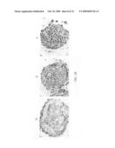 Use of histone deacetylase inhibitors in combination with radiation for the treatment of cancer diagram and image