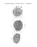 Use of histone deacetylase inhibitors in combination with radiation for the treatment of cancer diagram and image