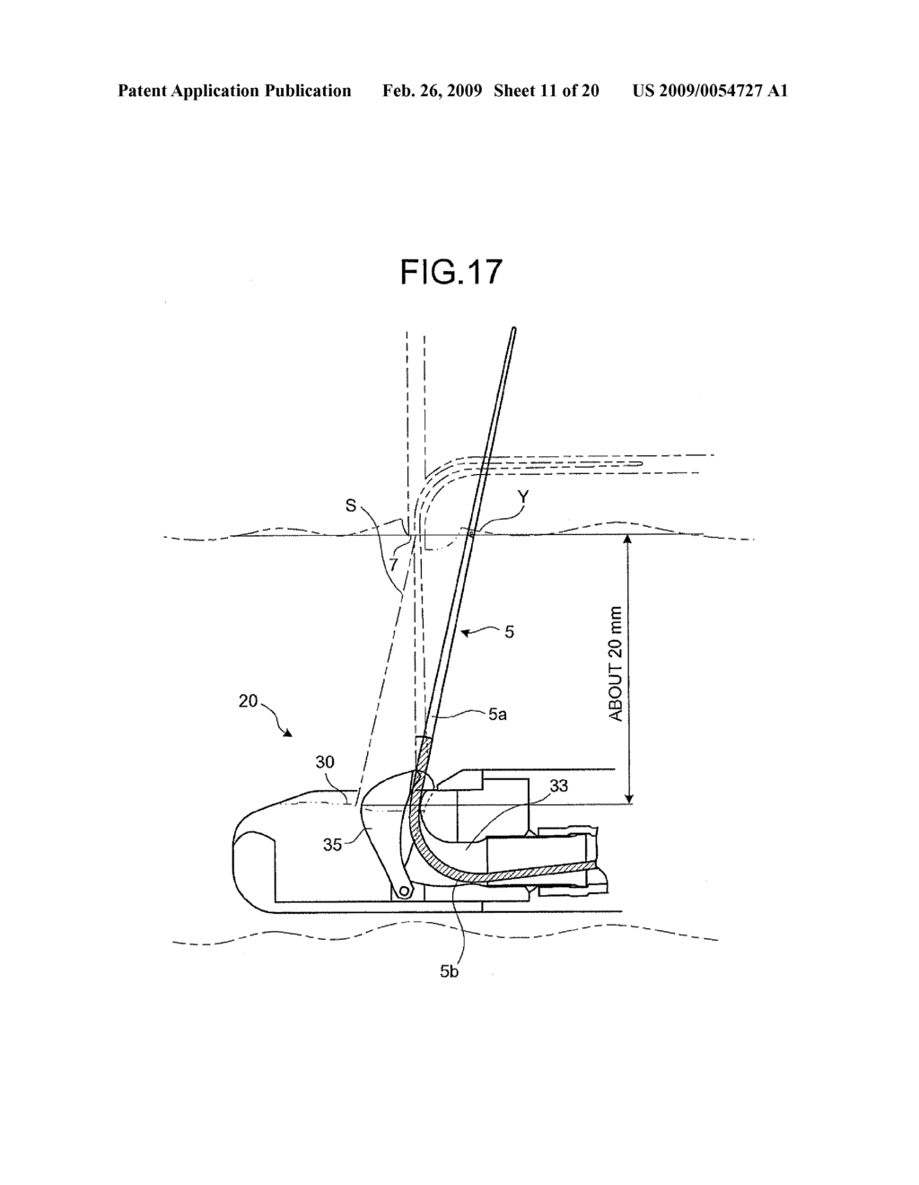 ENDOSCOPE - diagram, schematic, and image 12