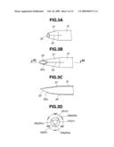 Medical Treatment Device diagram and image