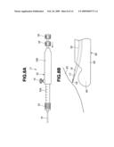 Medical Treatment Device diagram and image