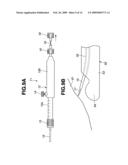 Medical Treatment Device diagram and image