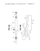 Medical Treatment Device diagram and image