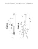 Medical Treatment Device diagram and image