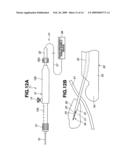 Medical Treatment Device diagram and image