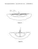 APPARATUS FOR ASPIRATING, IRRIGATING AND/OR CLEANSING OF WOUNDS diagram and image