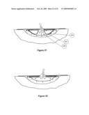 APPARATUS FOR ASPIRATING, IRRIGATING AND/OR CLEANSING OF WOUNDS diagram and image