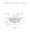 APPARATUS FOR ASPIRATING, IRRIGATING AND/OR CLEANSING OF WOUNDS diagram and image