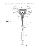 Uterine Therapy Device and Method diagram and image