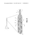 Uterine Therapy Device and Method diagram and image