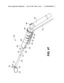 Uterine Therapy Device and Method diagram and image