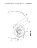 Uterine Therapy Device and Method diagram and image