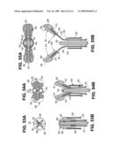 Uterine Therapy Device and Method diagram and image