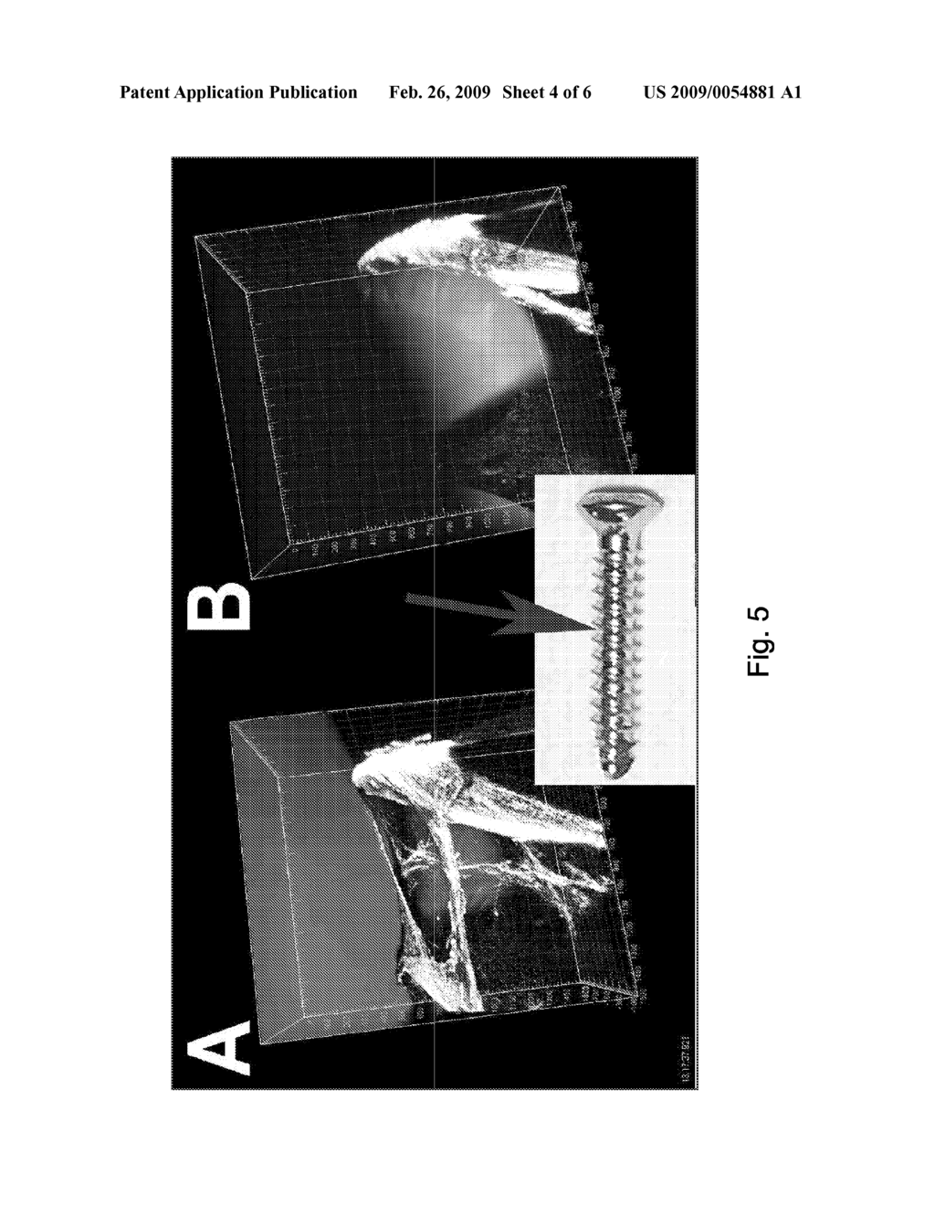 MAMMALIAN BIOFILM TREATMENT PROCESSES AND INSTRUMENTS - diagram, schematic, and image 05