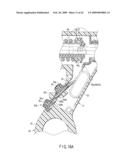 SURGICAL OPERATING APPARATUS diagram and image