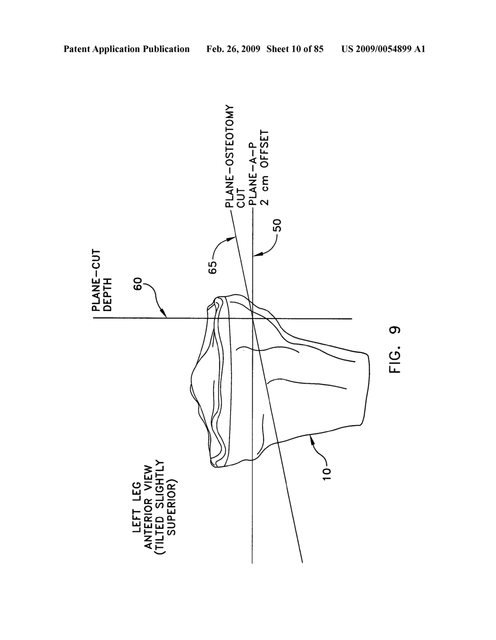 Method and apparatus for performing an open wedge, high tibial osteotomy - diagram, schematic, and image 11