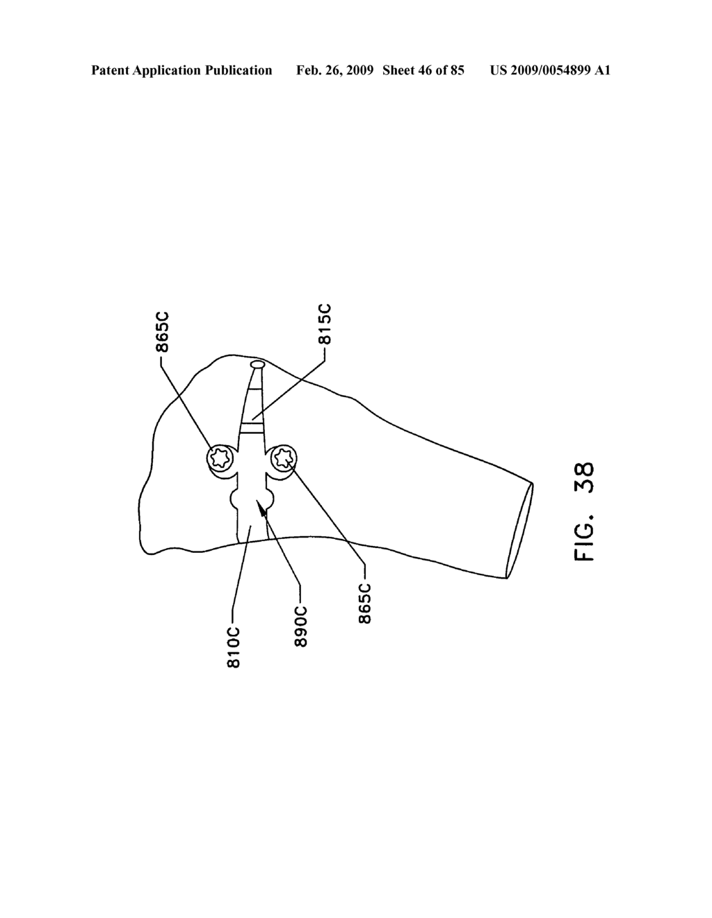 Method and apparatus for performing an open wedge, high tibial osteotomy - diagram, schematic, and image 47