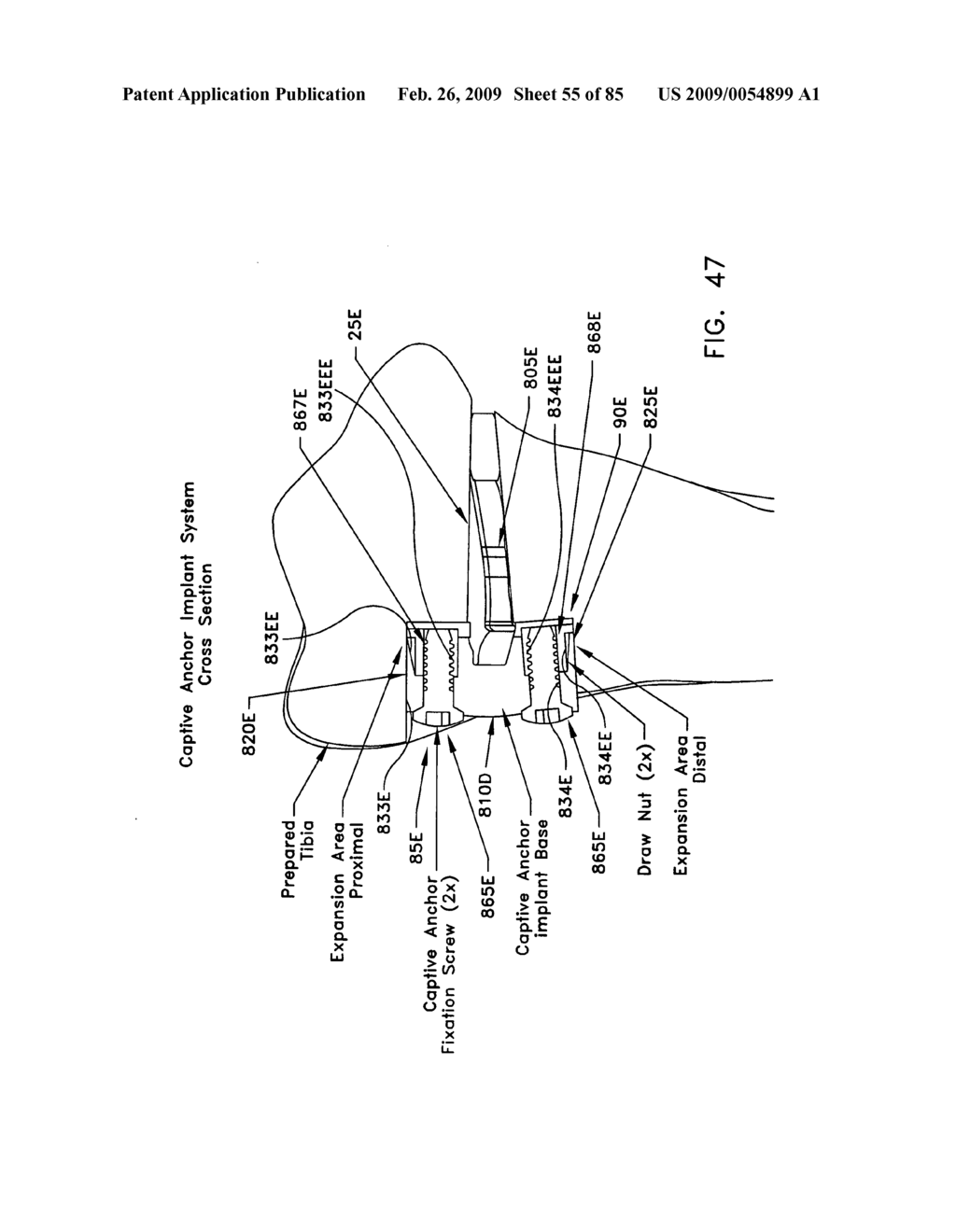 Method and apparatus for performing an open wedge, high tibial osteotomy - diagram, schematic, and image 56