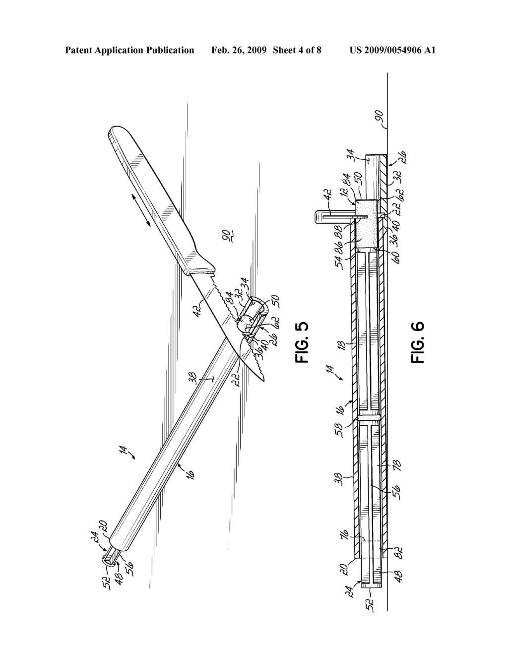 MEDICAL DEVICE AND METHOD FOR DELIVERING AN IMPLANT TO AN ANATOMICAL SITE - diagram, schematic, and image 05