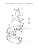 SURGICAL THREADING DEVICE AND METHOD FOR USING SAME diagram and image